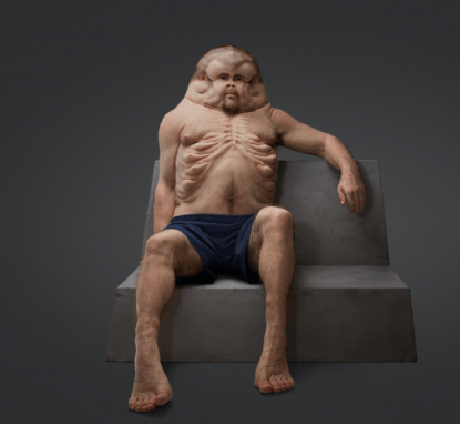 Graham, o “super-humano” capaz de sobreviver a acidentes de trânsito